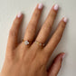 RING STONE
